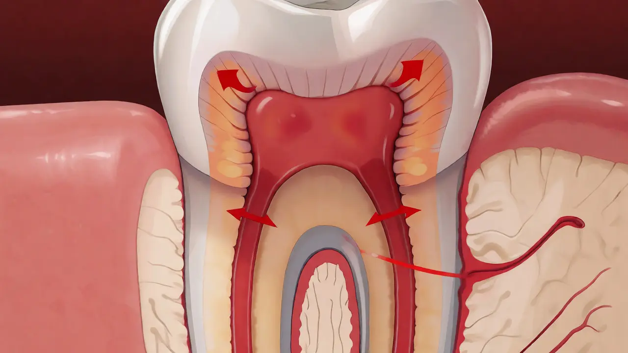 Anatomický řez zubem se zánětlivou dření uvnitř